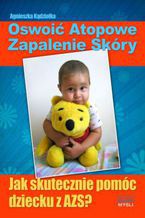 Okładka - Oswoić atopowe zapalenie skóry - Agnieszka Kądziołka