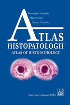 Okładka - Atlas histopatologii.Tajemniczy świat chorych komórek człowieka - Wenancjusz Domagała, Maria Chosia, Elżbieta Urasińska