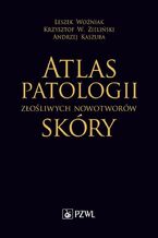 Okładka - Atlas patologii złośliwych nowotworów skóry - Leszek Woźniak, Krzysztof W. Zieliński, Andrzej Kaszuba