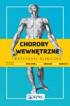 Okładka - Choroby wewnętrzne. Przypadki kliniczne - Wiesława Duda-Król, Marcin Wełnicki, Artur Mamcarz