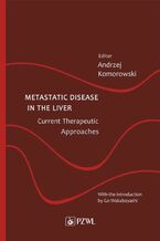 Okładka - Metastatic Disease in the Liver - Current Therapeutic Approaches - Andrzej Komorowski