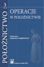 Okładka - Położnictwo. Tom 3. Operacje w położnictwie - Grzegorz H. Bręborowicz