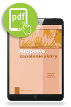 Okładka - Atopowe zapalenie skóry - Roman J. Nowicki