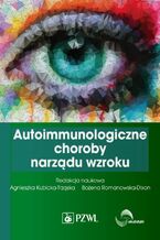 Okładka - Autoimmunologiczne choroby narządu wzroku - Agnieszka Kubicka-Trząska, Bożena Romanowska-Dixon