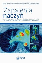 Okładka - Zapalenia naczyń w praktyce klinicznej interdyscyplinarnie - Rafał Małecki, Mariusz Kusztal, Piotr Wiland, Marek Brzosko