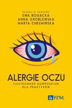 Okładka - Alergie oczu. Ilustrowane kompendium dla praktyków - Ewa Bogacka, Anna Groblewska, Marta Chełmińska