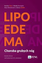 Okładka - Lipoedema - Karolina Chęś, Monika Domagała, Artur Mieczkowski, Dorota Stettler