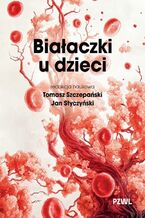 Okładka - Białaczki u dzieci - Tomasz Szczepański, Jan Styczyński