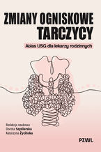 Okładka - Zmiany ogniskowe tarczycy - Dorota Szydlarska, Katarzyna Życińska