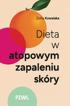 Okładka - Dieta w atopowym zapaleniu skóry - Zofia Kowalska