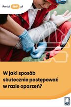 Okładka - W jaki sposób skutecznie postępować w razie oparzeń? - Adam M. Pietrzak