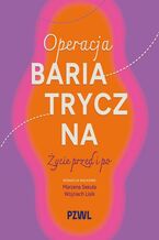 Okładka - Operacja bariatryczna. Życie przed i po - Marzena Sekuła, Wojciech Lisik