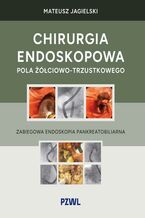 Okładka - Chirurgia endoskopowa pola żółciowo-trzustkowego - Mateusz Jagielski