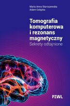 Okładka - Tomografia komputerowa i rezonans magnetyczny - Maria Anna Staniszewska, Adam Gałązka