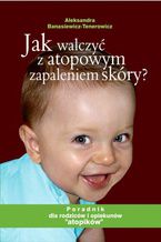Okładka - Jak walczyć z atopowym zapaleniem skóry - Banasiewicz-Tenerowicz Aleksandra