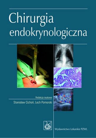 Chirurgia endokrynologiczna Lech Pomorski, Stanisław Cichoń - okladka książki