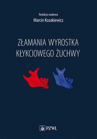 Złamania wyrostka kłykciowego żuchwy Marcin Kozakiewicz - okladka książki
